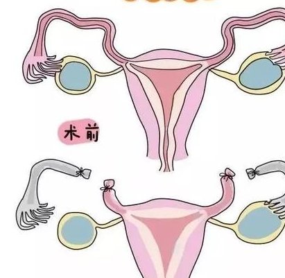 成都做试管婴儿的医院哪家强？附成都做试管婴儿较好的医院排名！